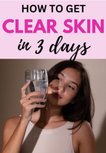 How to Clear Skin in 3 Days